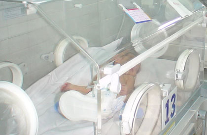 Trẻ sinh non tháng được chăm sóc trong lồng kính. Ảnh: N.Hữu