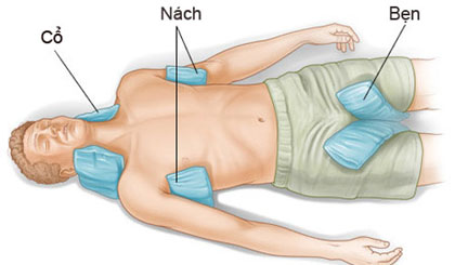 Áp  túi nước đá vào nách, bẹn, cổ và lưng bệnh nhân vị sốc nhiệt để làm giảm nhiệt độ cơ thể 