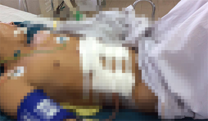 Bệnh nhân B. đang được theo dõi sau phẫu thuật tại Bệnh viện Đa khoa trung tâm Tiền Giang.