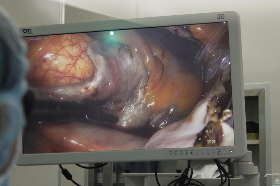 Công nghệ 3D khiến phẫu thuật trở nên vô cùng “thật” như phẫu trường rõ nét (quả tim, mạch máu, phổi…). Ảnh: VGP/Thúy Hà
