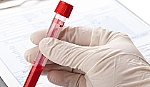 Phương pháp xét nghiệm máu mới giúp phát hiện ung thư từ rất sớm