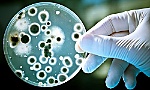 Siêu vi khuẩn kháng thuốc giết chết 33.000 người mỗi năm tại châu Âu