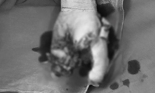 Bàn tay của bệnh nhân bị dập nát do điện thoại phát nổ. (Ảnh: PV/Vietnam+)