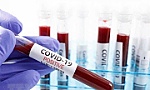 Anh gấp rút sản xuất 1 triệu liều vắcxin phòng bệnh COVID-19