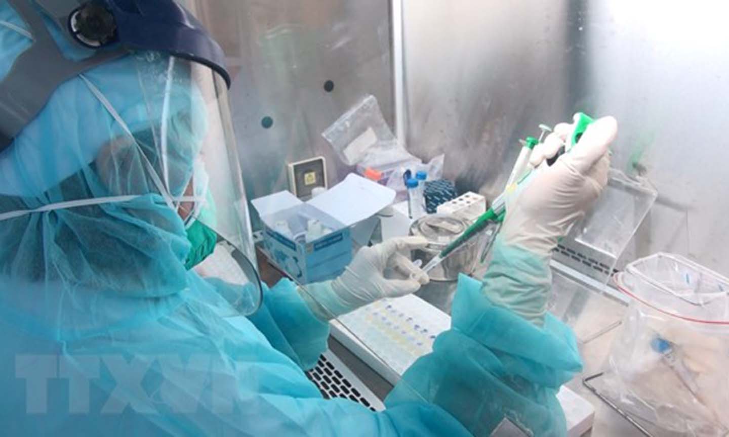 Một phòng xét nghiệm sinh học phân tử chẩn đoán bệnh truyền nhiễm và COVID-19. (Ảnh: TTXVN/Vietnam+)