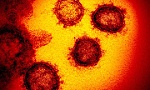 Ánh nắng Mặt Trời có thể vô hiệu hóa virus SARS-CoV-2