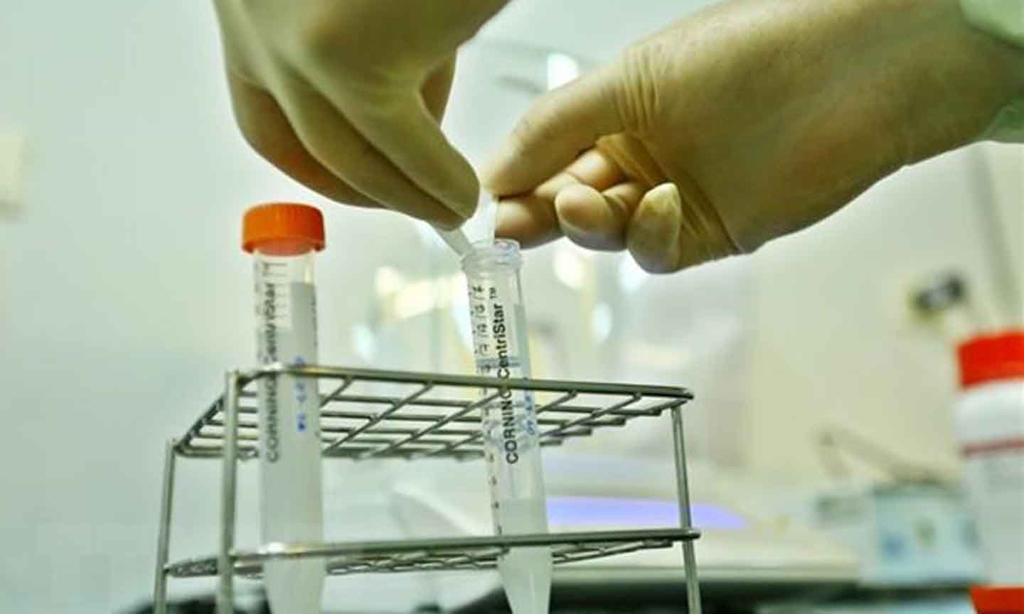  Bán thành phẩm của một loại vắcxin sau quá trình nghiên cứu, điều chế trước khi được tiêm thử trên động vật. (Ảnh: Minh Quyết/TTXVN)