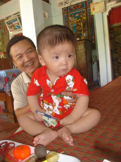 Niềm hy vọng con có tiến triển trong điều trị  vẫn được anh Lê Quang Huy thắp lên mỗi ngày.   