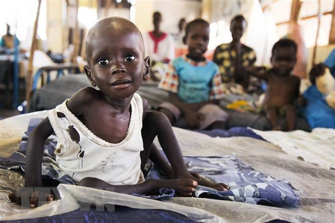 Trẻ em bị suy dinh dưỡng điều trị tại cơ sở y tế ở Aweil, Nam Sudan. (Ảnh: AFP/TTXVN)