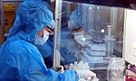 Việt Nam dự kiến thử nghiệm vaccine Covid-19 trong tháng 11