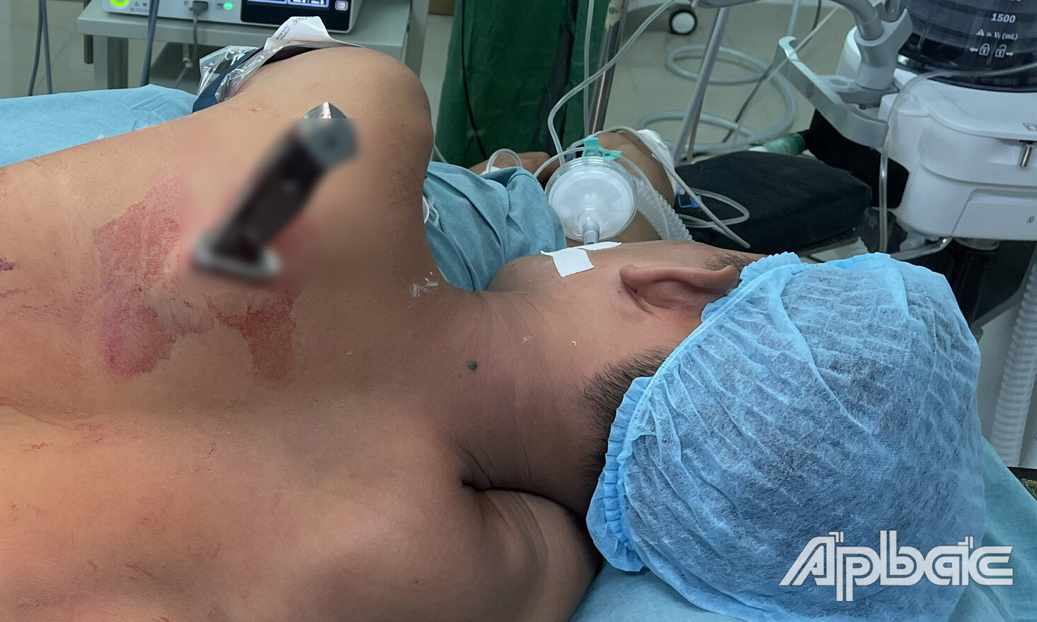 Kiểng được đưa đến bệnh viện cấp cứu. Ảnh: Bệnh viện Đa khoa Trung tâm tỉnh Tiền Giang.
