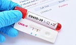 Người bệnh không phải chi trả xét nghiệm COVID-19 khi đến khám và điều trị tại cơ sở y tế công lập