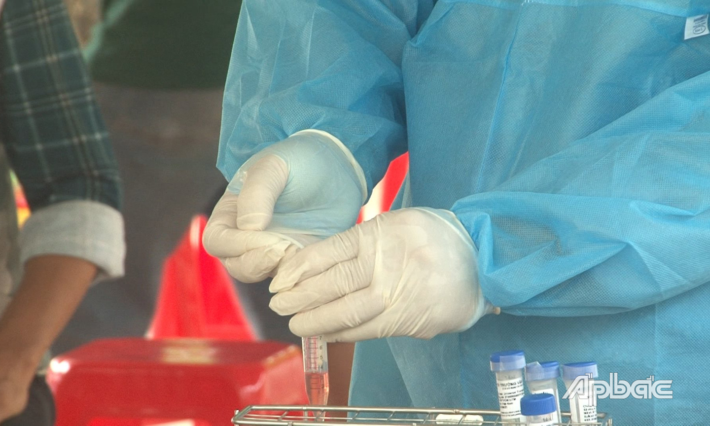 Toàn bộ công nhân đã được lấy mẫu xét nghiệm Covid-19 bằng phương pháp RT- PCR