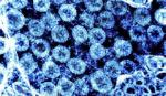 SARS-CoV-2 tiến hóa để vượt qua hệ miễn dịch bẩm sinh của con người