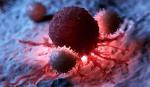 Cỗ máy nano xâm nhập và tiêu diệt tế bào ung thư