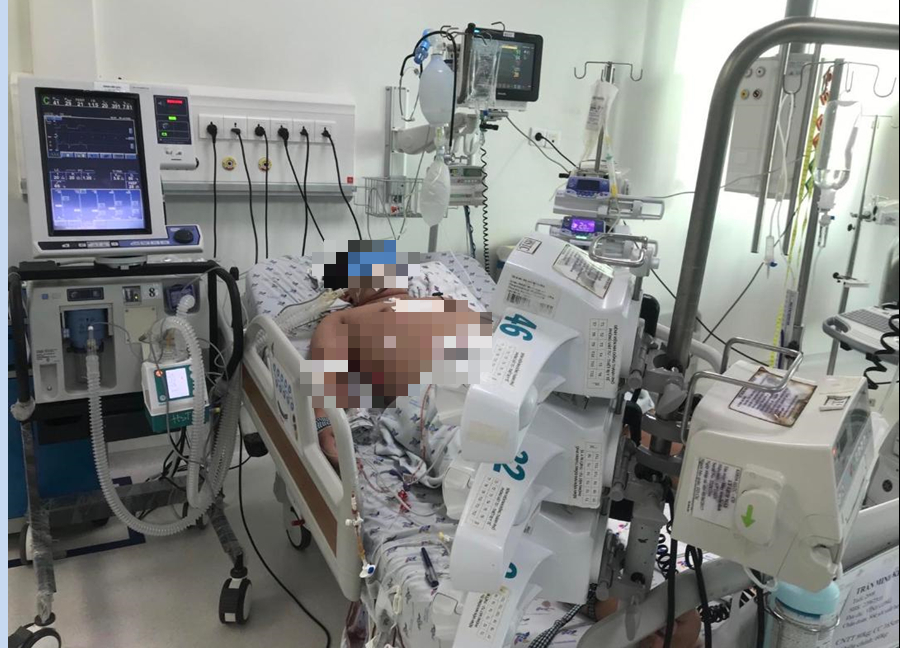 Bé T.M.K. 14 tuổi, cân nặng 72 kg bị sốc sốt xuất huyết nặng trên cơ địa béo phì điều trị tại Bệnh viện Nhi đồng Thành phố (TP HCM) Ảnh: BVCC