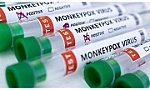 Hướng dẫn phòng ngừa lây nhiễm bệnh đậu mùa khỉ trong cơ sở khám bệnh, chữa bệnh