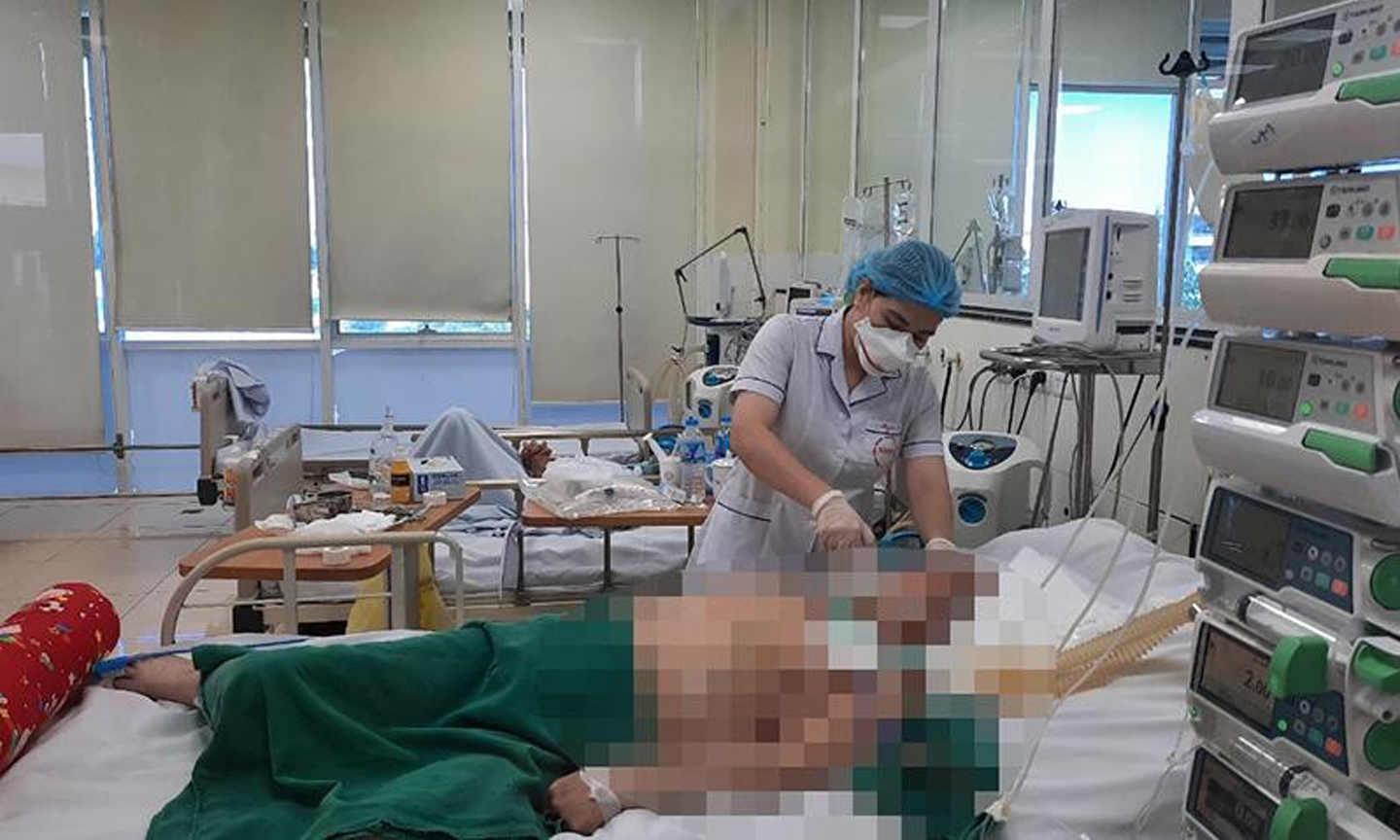 Bệnh nhân Covid-19 nặng điều trị tại Bệnh viện Bệnh Nhiệt đới Trung ương.