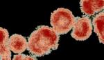 Việt Nam chưa xét nghiệm được virus corona mới