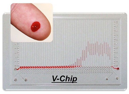 V-Chip có khả năng thực hiện 50 xét nghiệm máu trong tích-tắc. Ảnh: AFP