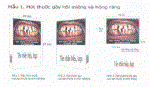 In cảnh báo sức khỏe phải chiếm 50% diện tích vỏ bao thuốc lá