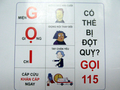 Sơ đồ về nhận biết đột quỵ.