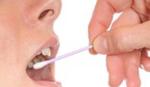 Chế tạo dụng cụ phát hiện nhanh ung thư qua thử nước bọt