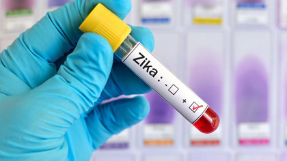 Random blood tests in Vietnam have not found the Zika virus. Photo credit: Shutterstock Random blood tests in Vietnam have not found the Zika virus. Photo credit: Shutterstock