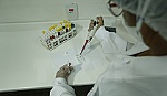 Công bố phương pháp thử mới phát hiện virus Zika trong 20 phút