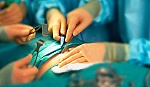 Phẫu thuật thắt dạ dày giúp điều trị bệnh tiểu đường tuýp 2