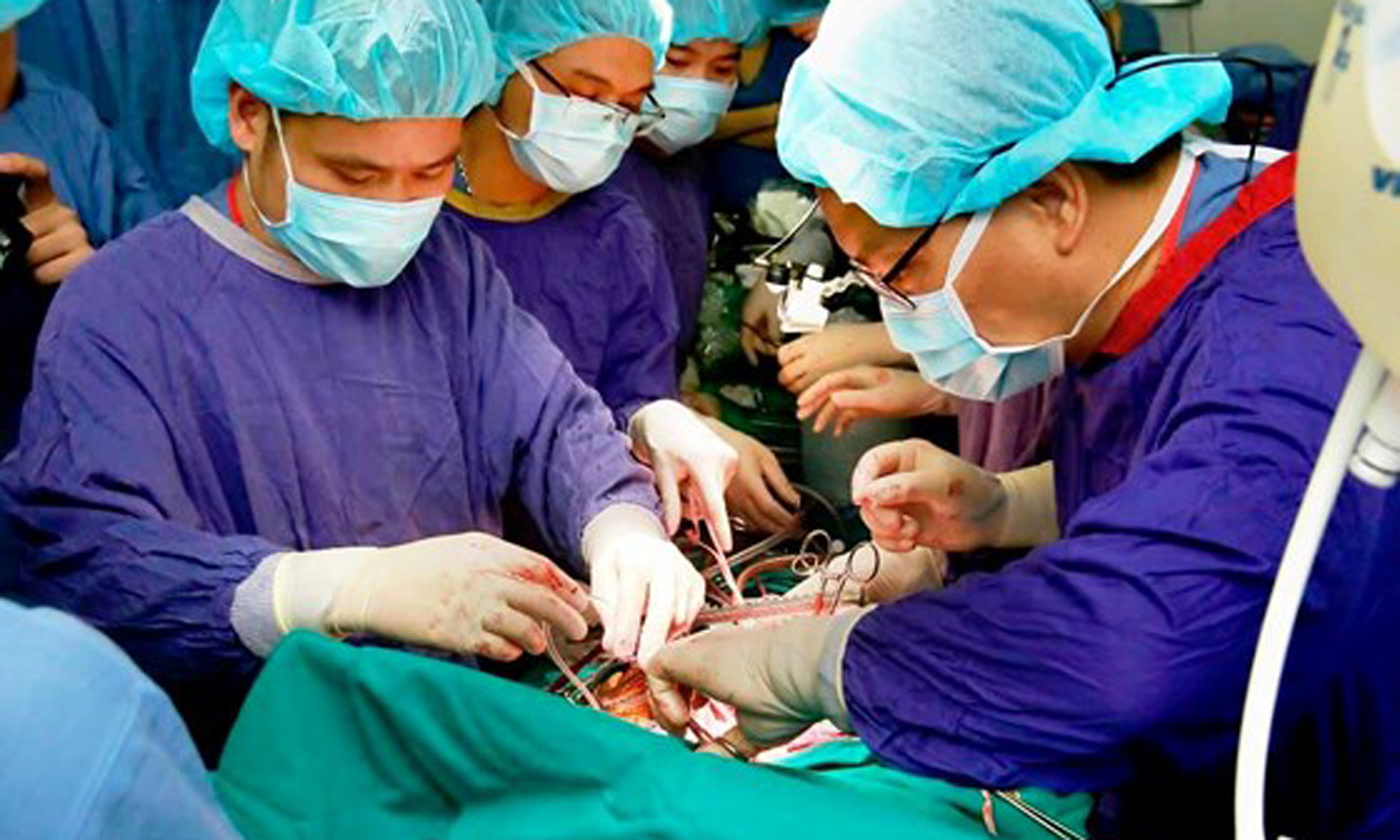 Các bác sĩ BV Việt Đức đang thực hiện ca ghép gan