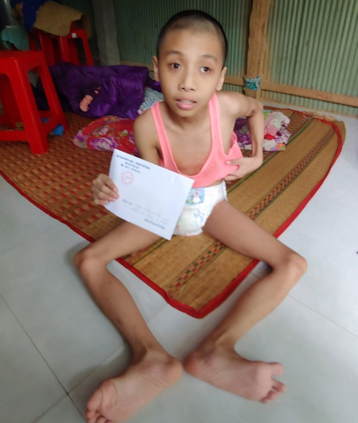 NNCĐDC Phan Hoài Nhân (ấp Tân Phong, xã Tân Hội) bị bại liệt thường xuyên được cán bộ Hội NNCĐDC xã Tân Hội, TX. Cai Lậy đến thăm hỏi, tặng quà.