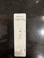 Có thể biết được tải lượng virus SARS-CoV-2 qua vạch đậm hay nhạt trên kit test?