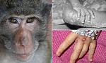 6 biện pháp phòng chống dịch bệnh đậu mùa khỉ