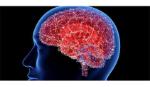 Hội chứng COVID kéo dài có thể liên quan đến thay đổi chức năng não bộ