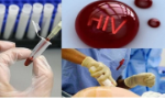 Điều kiện xác định người bị phơi nhiễm HIV, nhiễm HIV do tai nạn rủi ro nghề nghiệp