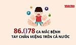 [Infographic] 86.078 ca mắc bệnh tay chân miệng trên cả nước