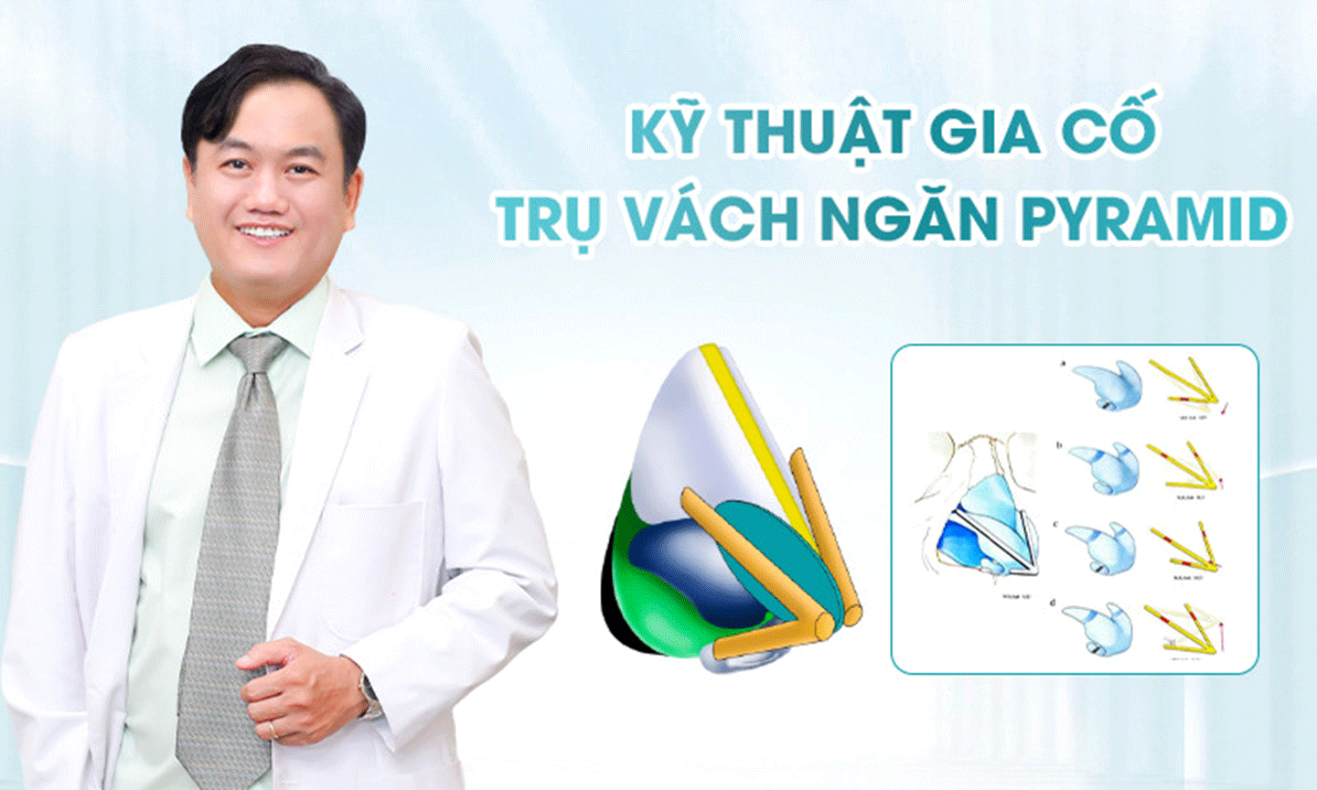 ThS.BS Lê Viết Trí - Cha đẻ của kỹ thuật Pyramid gia cố trụ vách ngăn vững chắc.