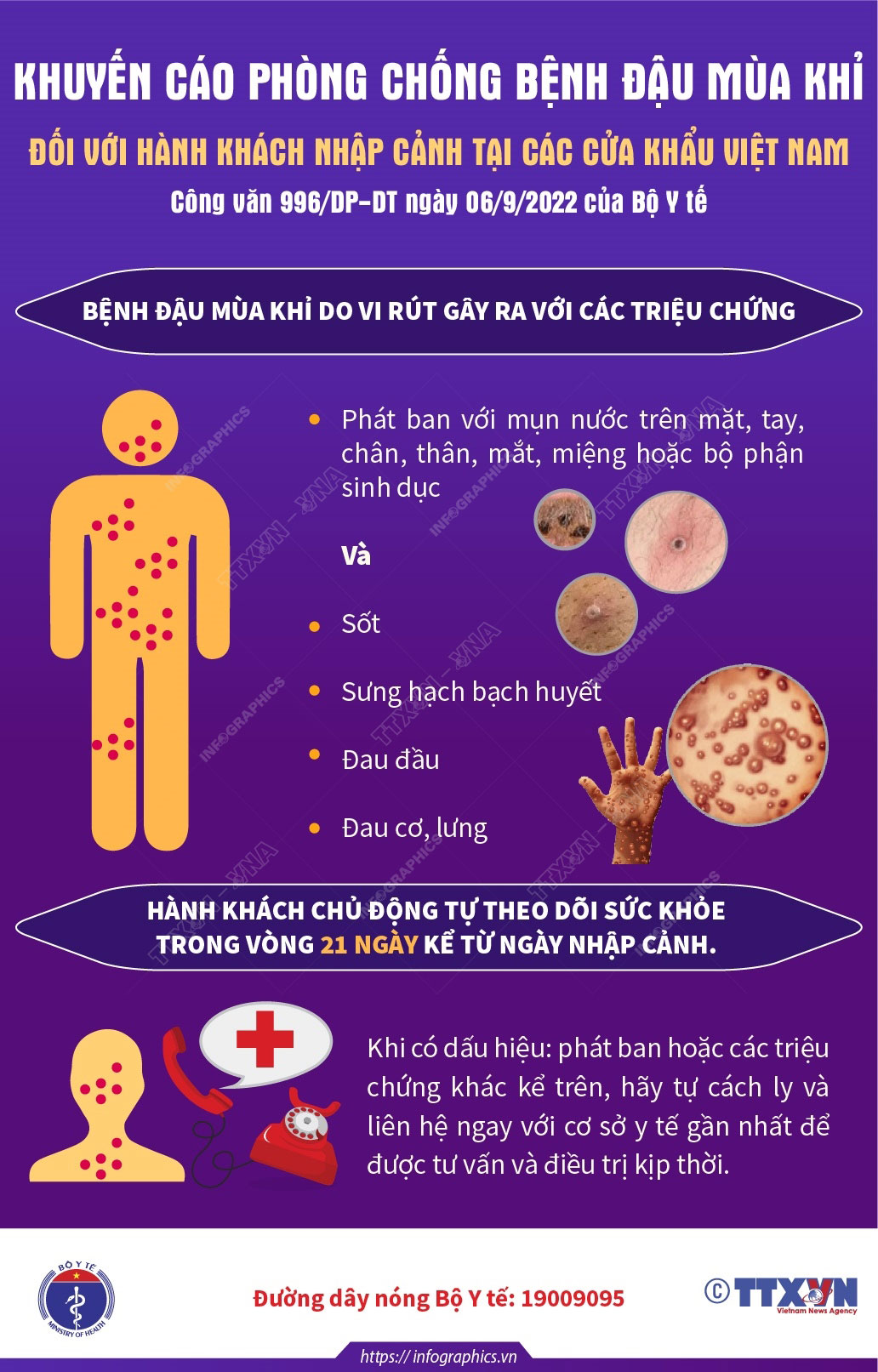 Khuyến cáo phòng,  chống đậu mùa khỉ