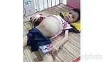 Một trường hợp trẻ bệnh hiểm nghèo cần giúp đỡ
