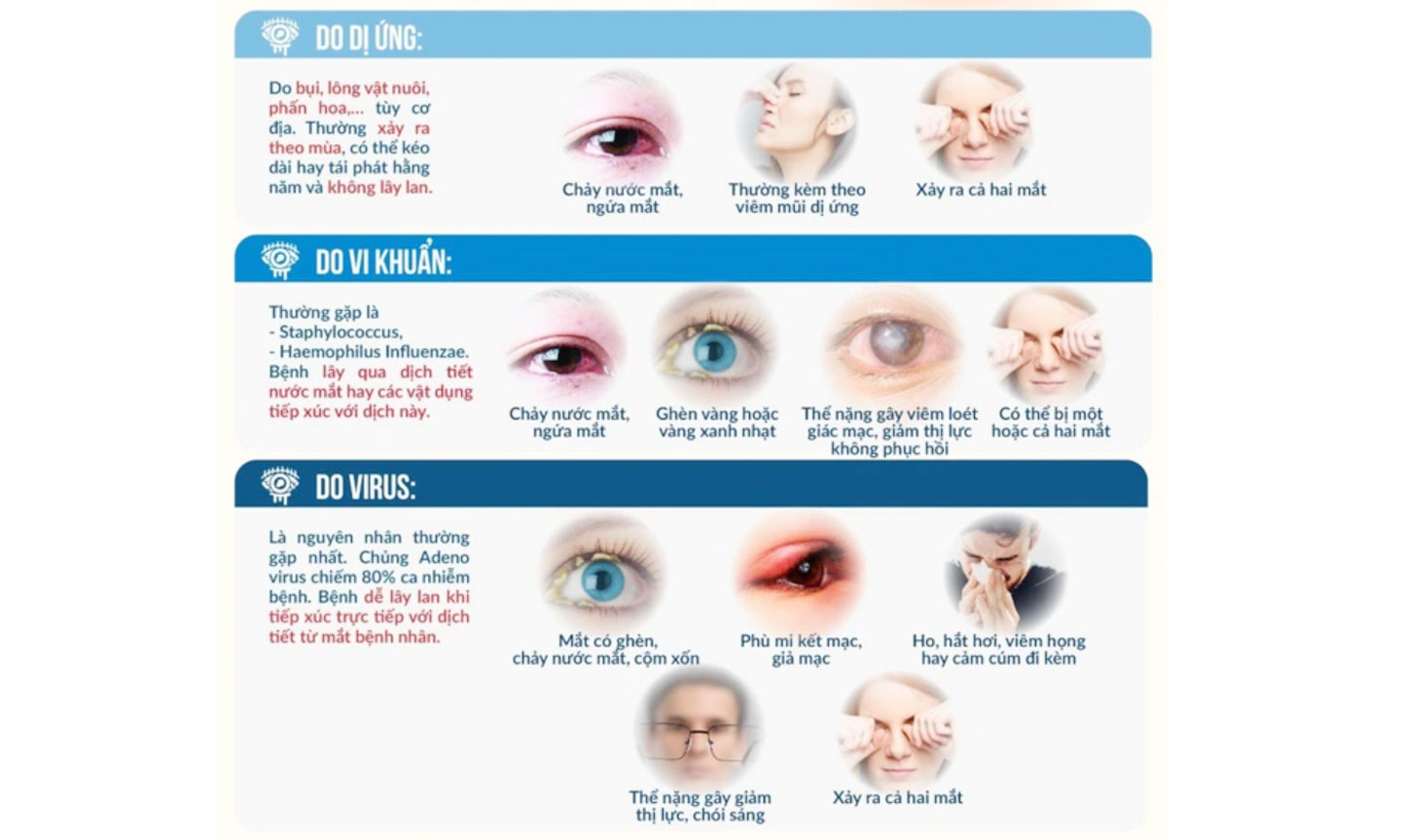 Có nhiều nguyên nhân gây bệnh khác nhau nhưng triệu chứng đầu tiên, dễ nhận thấy là mắt bị đỏ. 